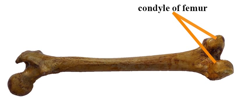condyle of femur